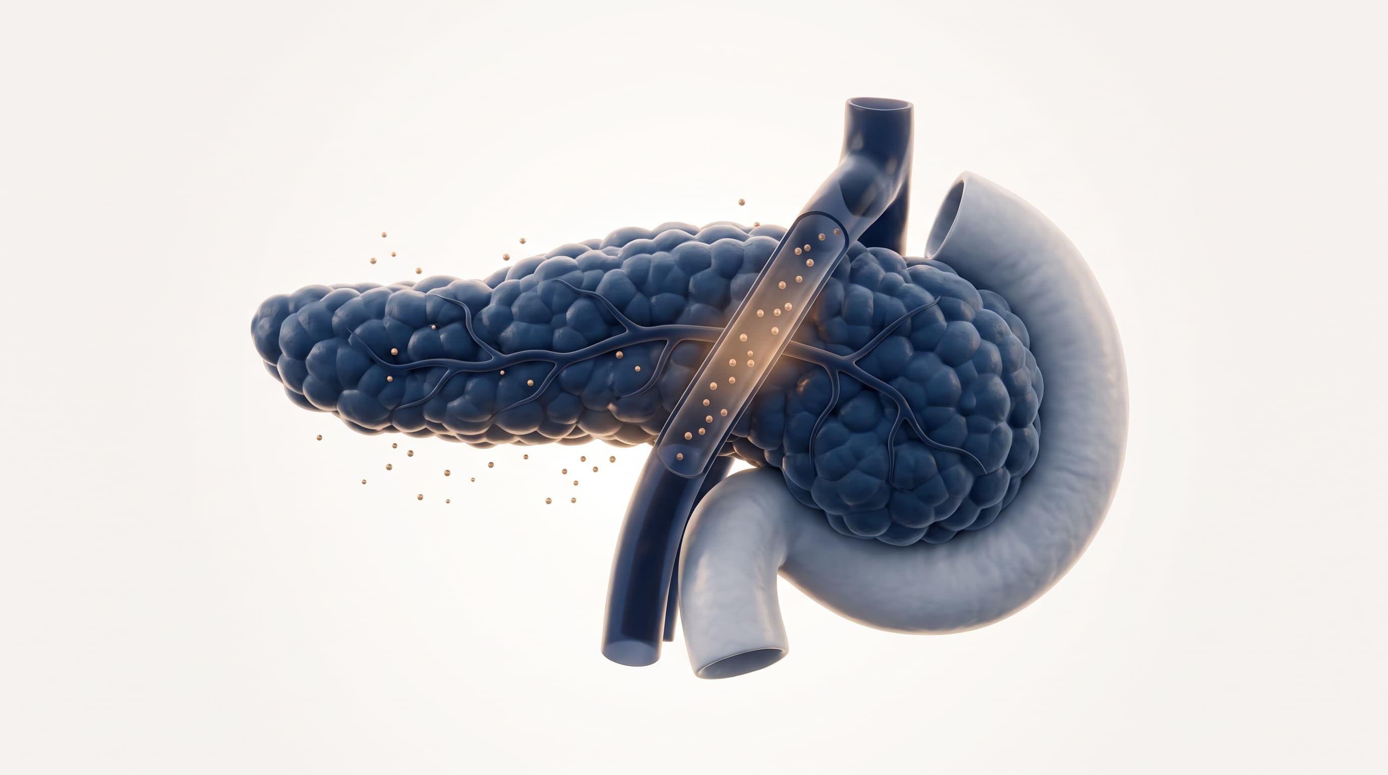 Diabetes Mellitus